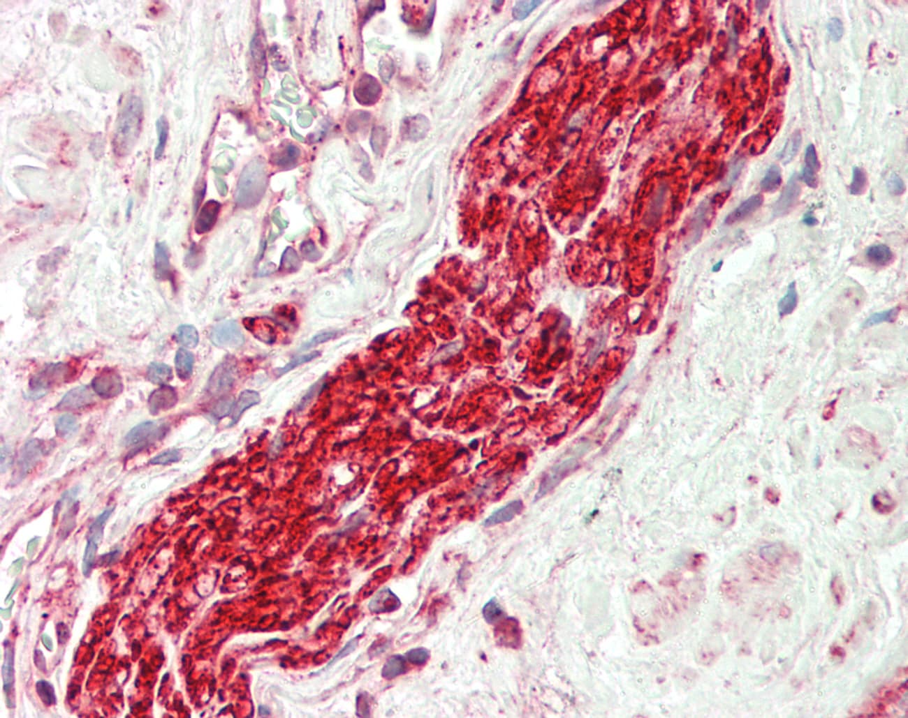 TUBB3 / Tubulin Beta 3 Antibody (C-Terminus)