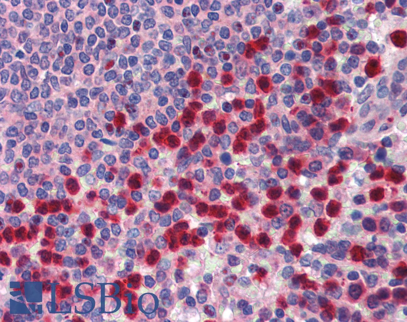 TRIM35 Antibody (aa359-408)