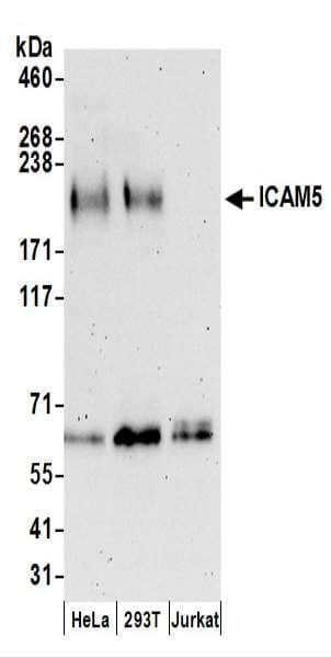 Polyclonal Rabbit anti-Human ICAM5 / ICAM-5 Antibody (aa874-924, IHC, WB)
