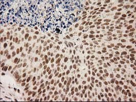 LOX / Lysyl Oxidase Antibody (clone OTI10D11)