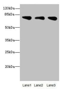 ACSS2 / ACAS2 Antibody