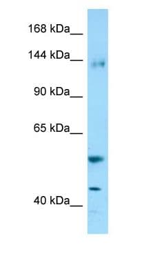 ENPEP / Aminopeptidase A Antibody (aa796-845)