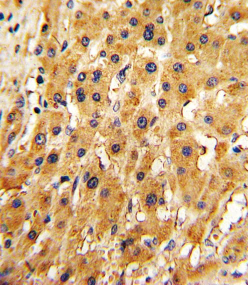 APRT Antibody (aa12-40)