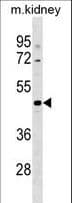 Polyclonal Rabbit anti-Human CCDC91 Antibody (aa322-350, WB)