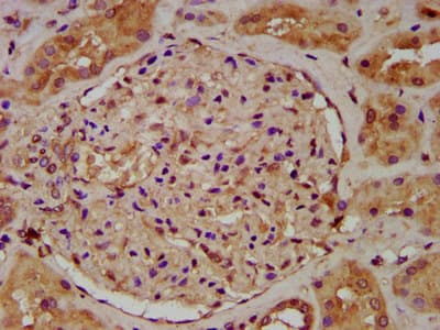 Polyclonal Rabbit anti-Human UGT1A6 Antibody (IHC)
