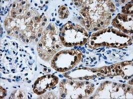 GBE1 Antibody (clone OTI4A1)