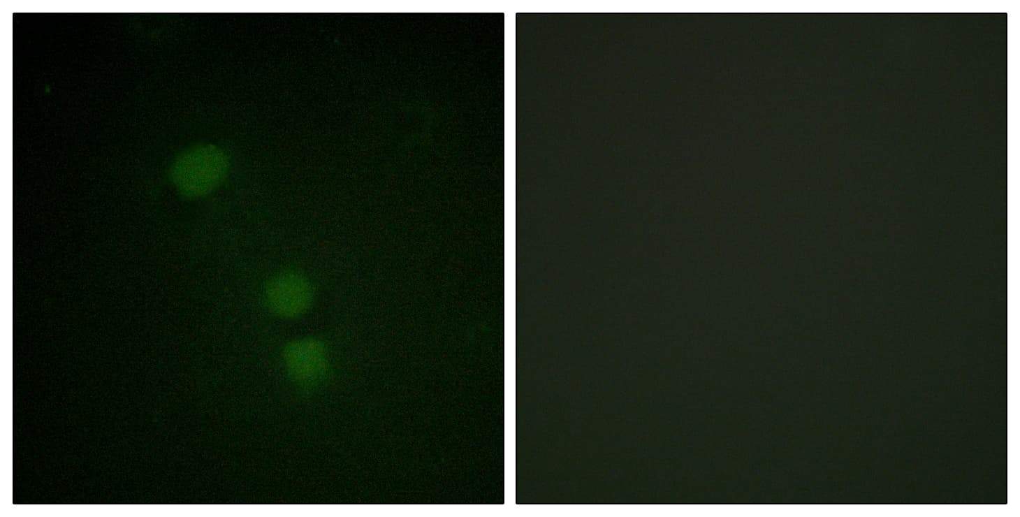 Polyclonal Rabbit anti-Human Histone H2B Antibody (Acetyl-Lys15, IHC, IF, WB)