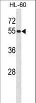 UBA3 / UBE1C Antibody (aa415-445)