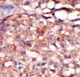 RIP4 / ANKRD3 Antibody (aa802-832)