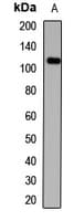 HAUS6 / FAM29A Antibody