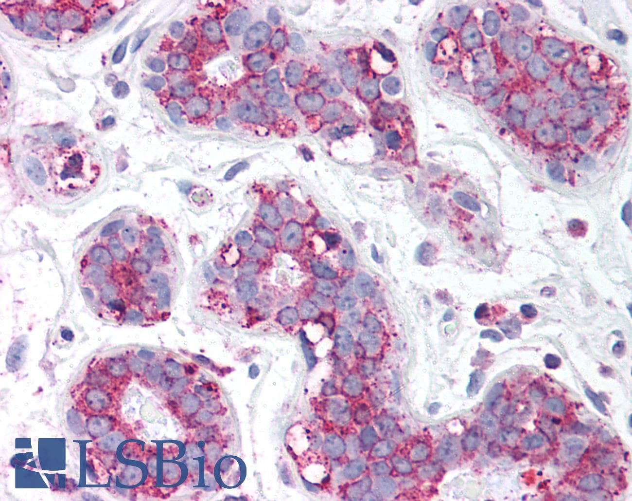 IHC-plus™ TBC1 / TBC1D1 Antibody