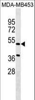 NPNT / Nephronectin Antibody (aa365-392)