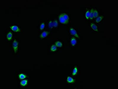 Polyclonal Rabbit anti-Human TMEM161A Antibody (IHC, WB)