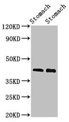 POU3F1 / OCT6 Antibody