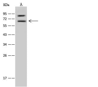 Polyclonal Rabbit anti-Human PTPN6 / SHP1 Antibody (IHC, WB)