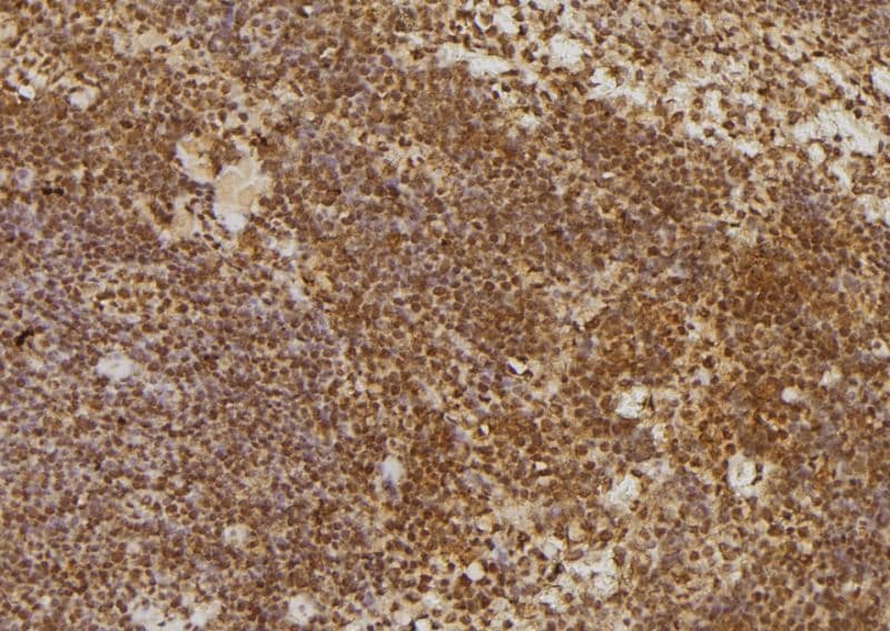 Calgizzarin / S100A11 Antibody