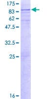 Human GNS Protein (Recombinant GST)