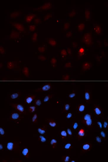 Polyclonal Rabbit anti-Human CDK1 / CDC2 Antibody (phospho-Thr14, IF, WB)