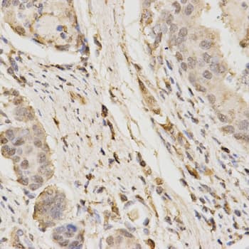 GLB1 / Beta-Galactosidase Antibody