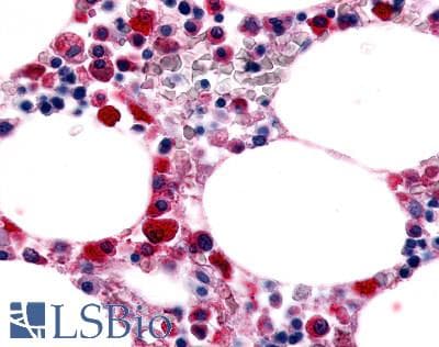 IHC-plus™ Polyclonal Rabbit anti-Human ADGRE1 / EMR1 Antibody (C-Terminus, IHC)