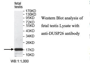 DUSP26 / MKP8 Antibody (aa2-211)
