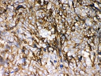 HLA-C Antibody