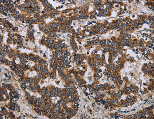 LGALS2 / Galectin 2 Antibody