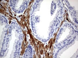 Hamartin / TSC1 Antibody (clone OTI3A2)