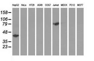 HP / Haptoglobin Antibody (clone OTI1B1)