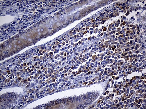 Monoclonal Mouse anti-Human FHIT Antibody (clone OTI1D7, IHC, WB)