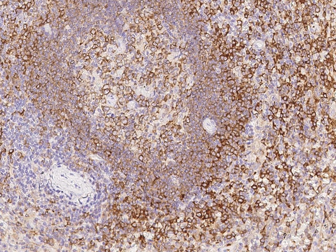 Polyclonal Rabbit anti-Human BCAP / PIK3AP1 Antibody (IHC)