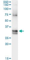 NIT1 Antibody (clone 1C3)