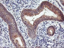 PDLIM2 / SLIM Antibody (clone OTI3B5)