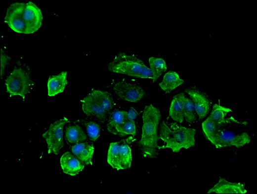 PLCB1 / Phospholipase C Beta 1 Antibody