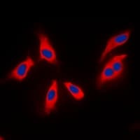 Polyclonal Rabbit anti-Human ARHGEF3 / XPLN Antibody (C-Terminus, IHC, IF, WB)