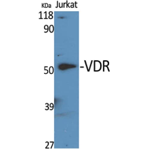 Vitamin D Receptor / VDR Antibody (150-230 aa)