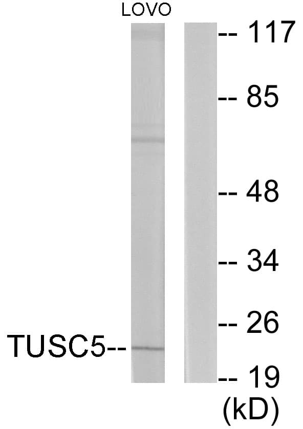 TUSC5 Antibody (aa1-50)