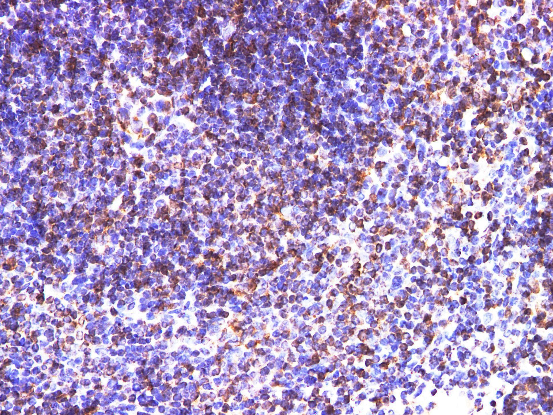 CD74 / CLIP Antibody