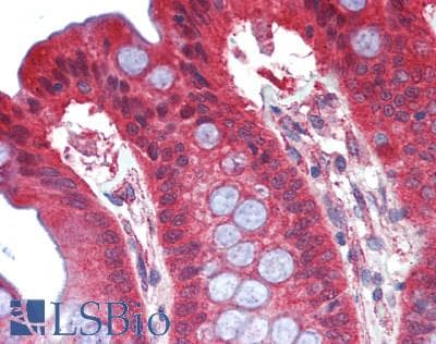 IHC-plus™ PAD2 / PADI2 Antibody (aa1-665)