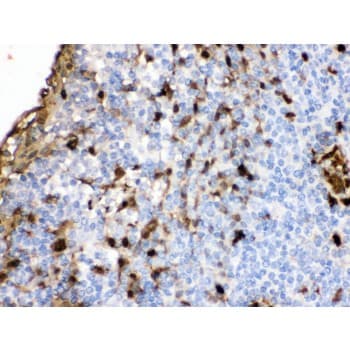 Polyclonal Rabbit anti-Human S100A9 / MRP14 Antibody (aa2-114, IHC, WB)