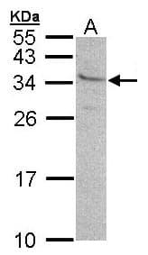 GEM / KIR Antibody (aa1-44)