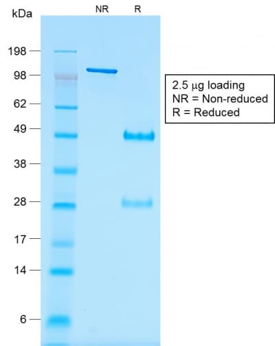 IHC-plus™ WT1 / Wilms Tumor 1 Antibody (clone rWT1/857)