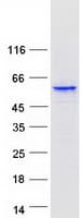 Human CYP3A5 Protein (Recombinant Myc-DDK (Flag))