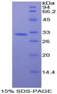 Human OSMR / IL-31R-Beta Protein (Recombinant His-T7)