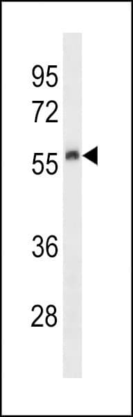 Polyclonal Rabbit anti-Mouse PLAU / Urokinase / uPA Antibody (aa304-331, WB)