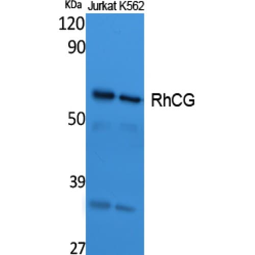 Polyclonal Rabbit anti-Human RHCG Antibody (Internal, WB)