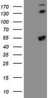SMS / Spermine Synthase Antibody (clone OTI3C9)
