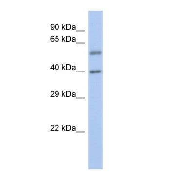 EYA3 Antibody (N-Terminus)