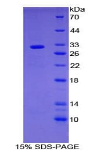 Mouse SHB Protein (Recombinant His-T7)