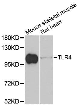 Polyclonal Rabbit anti-Human TLR4 Antibody (WB)